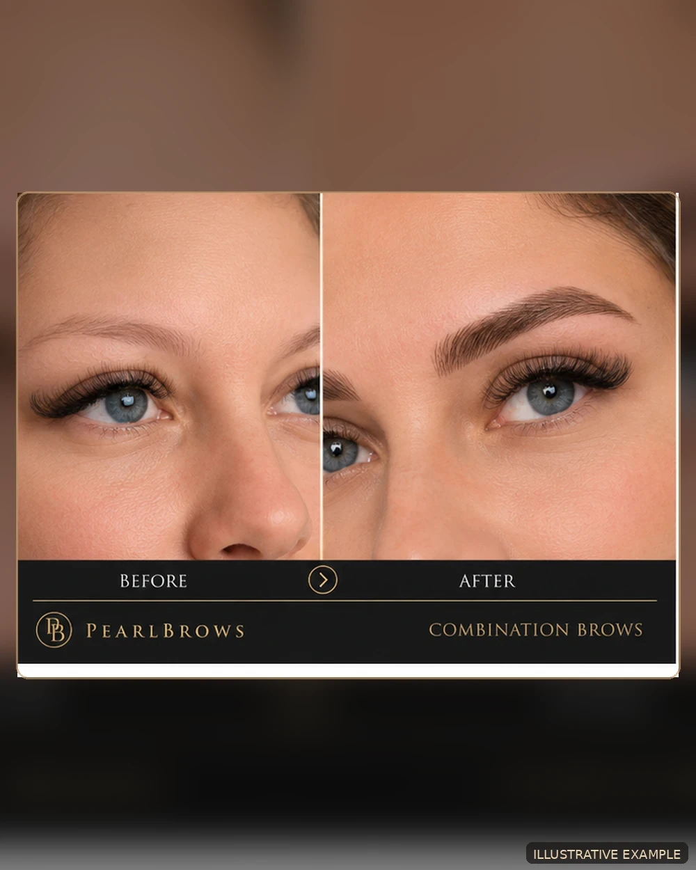 Illustrative combination brows before-and-after example for PearlBrows in St. Petersburg, Florida